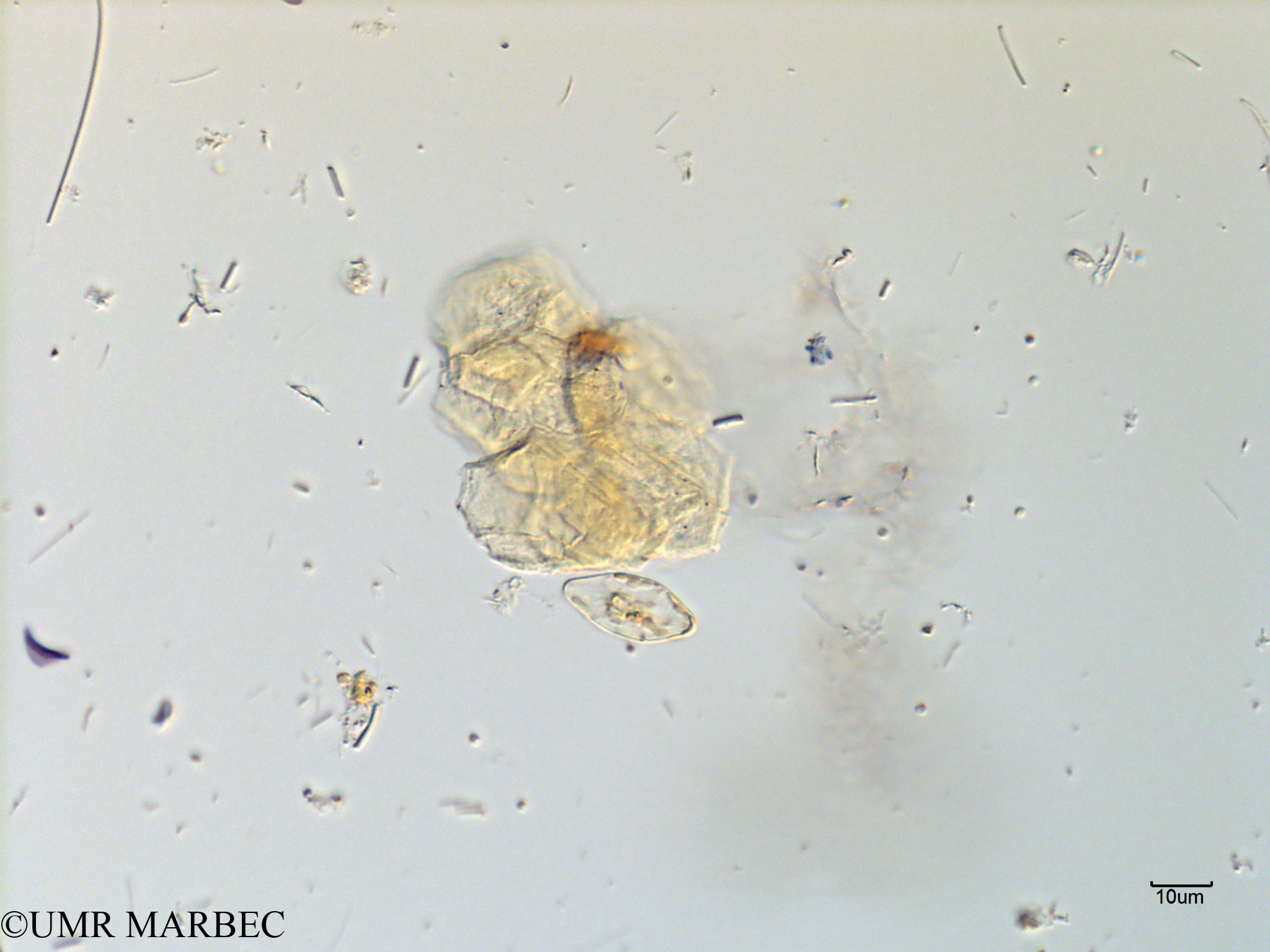 phyto/Scattered_Islands/mayotte_lagoon/SIREME May 2016/Gomphonema sp1 (MAY10_pennee laquelle c-4).tif(copy).jpg